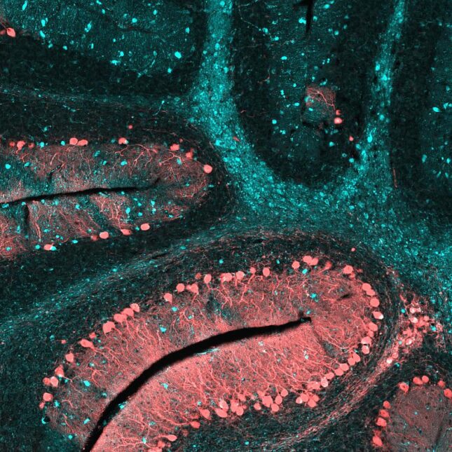 Scanned cerebellum of a mouse brain, affected by Niemann-Pick Type C, shown in pink and teal — biotech coverage from STAT