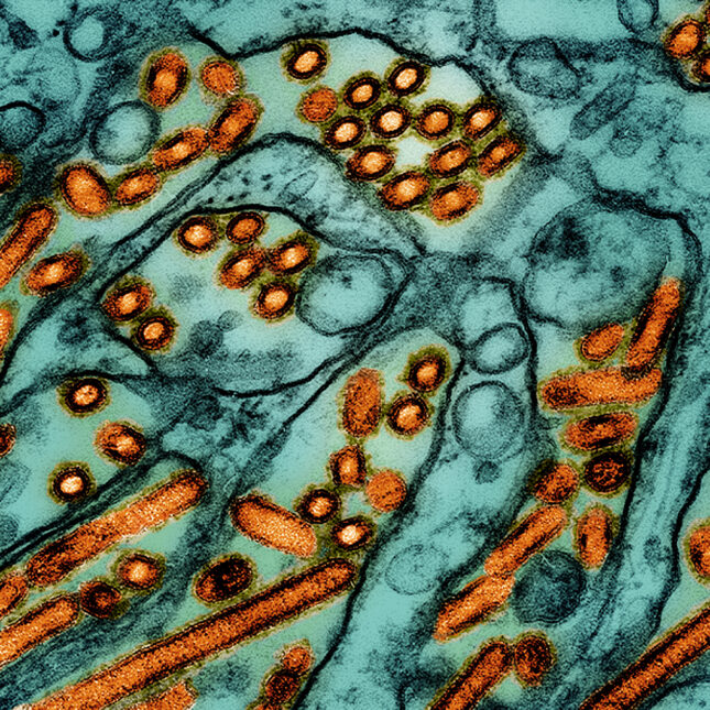 Avian Influenza A Virus colorized in orange in a teal environment — health coverage from STAT