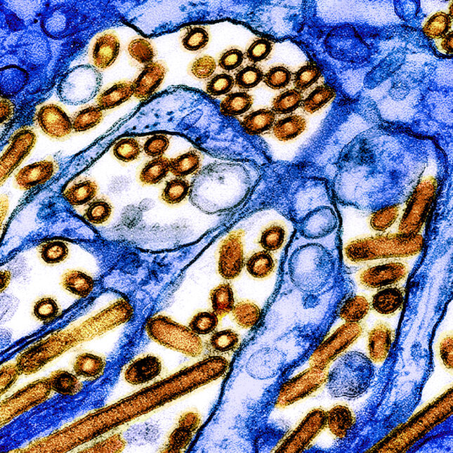 H5N1 virus particles, colorized in orange, appears in Madin-Darby Canine Kidney (MDCK) epithelial cells, colorized in blue — health coverage from STAT