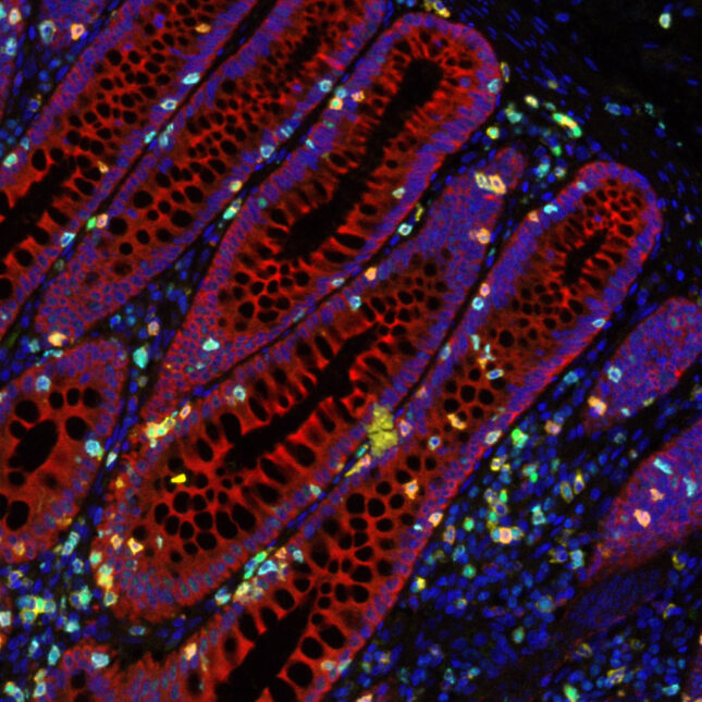 Representative fluorescent multiplex immunohistochemistry colorful staining of healthy human colon. -- cancer coverage from STAT